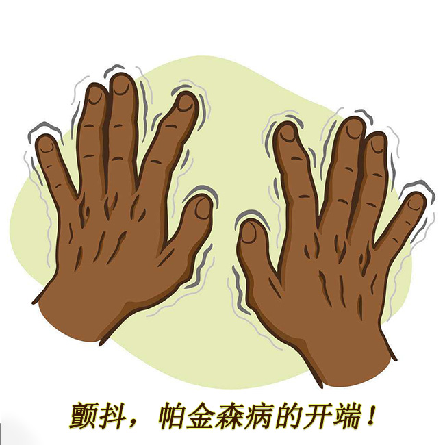 顫抖，帕金森病的開端 帕金森的早期癥狀